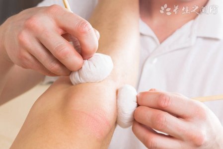 跑步后膝盖疼痛怎么办 跑完步膝盖疼怎么处理