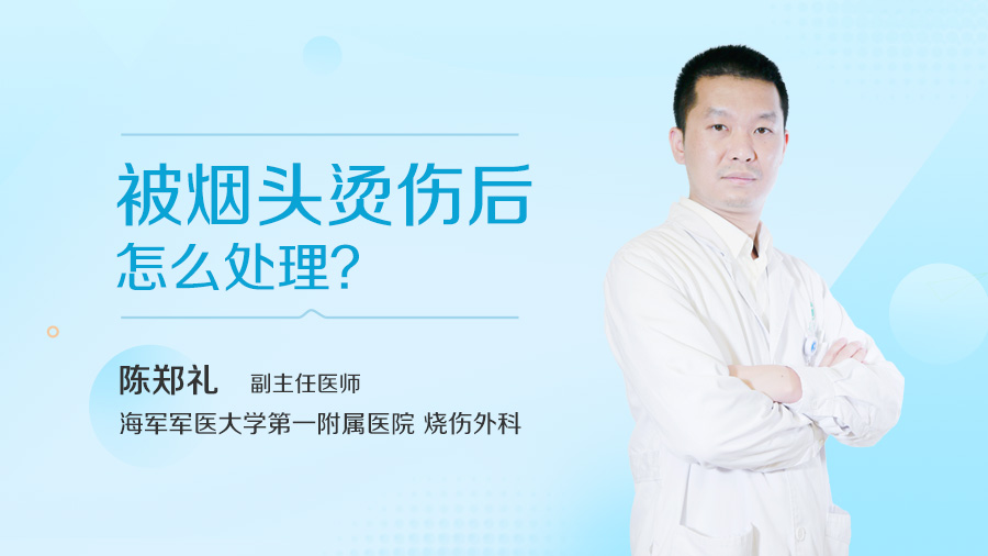 被烟头烫伤后怎么处理