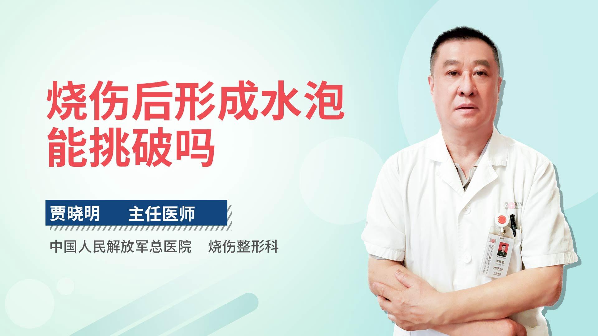 烧伤后形成水泡能挑破吗