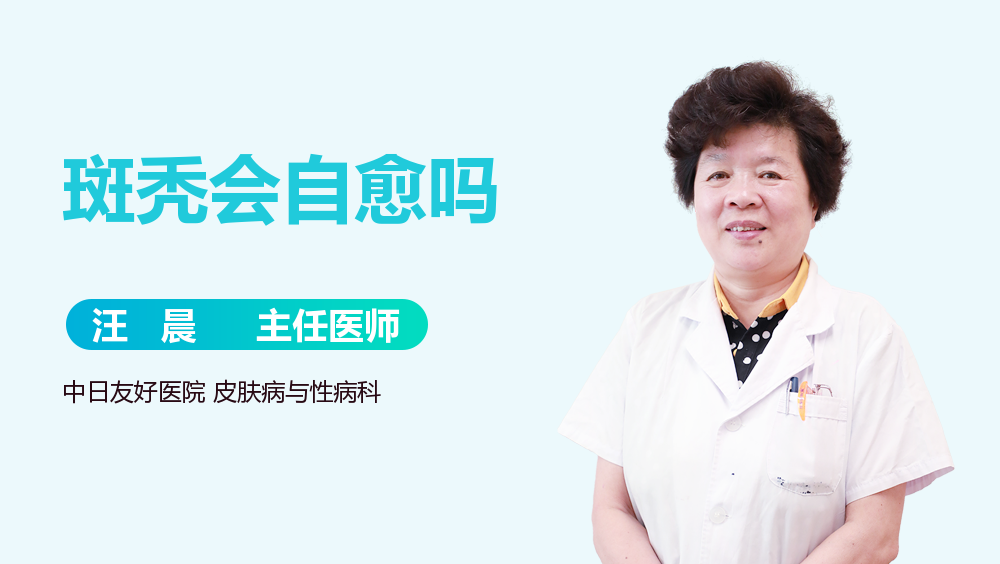 斑秃会自愈吗