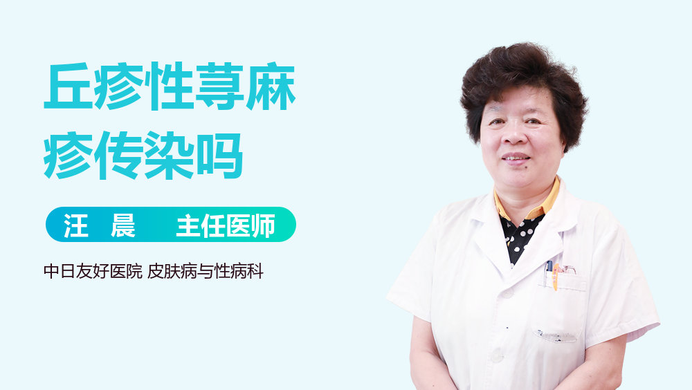 丘疹性荨麻疹传染吗