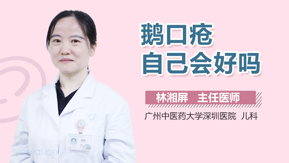 鹅口疮自己会好吗