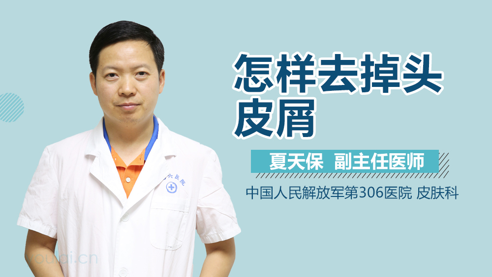 怎样去掉头皮屑