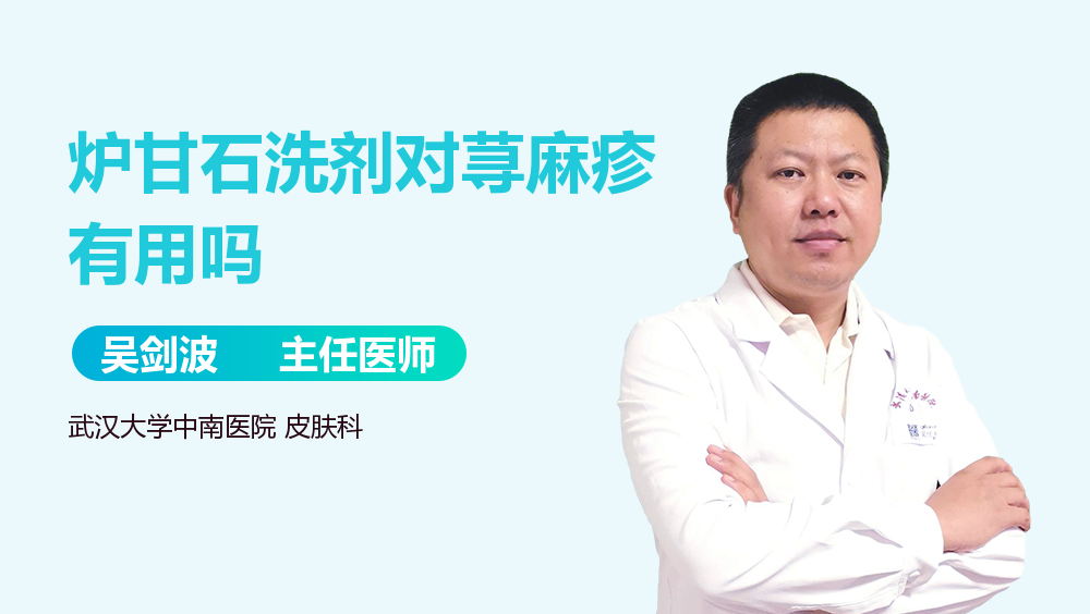炉甘石洗剂对荨麻疹有用吗