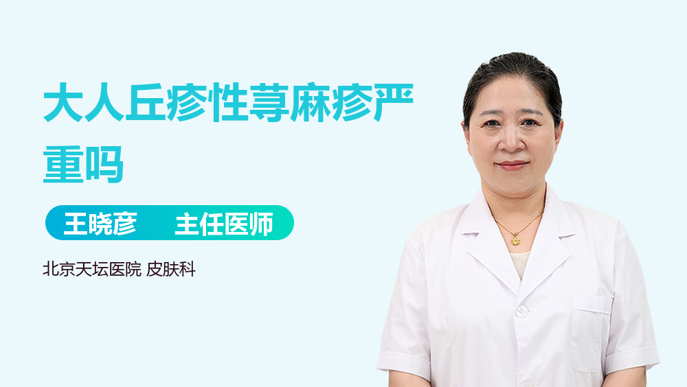大人丘疹性荨麻疹严重吗