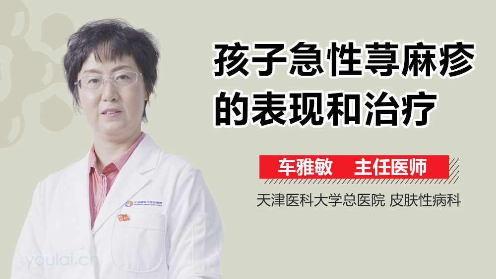 孩子急性荨麻疹的表现和治疗