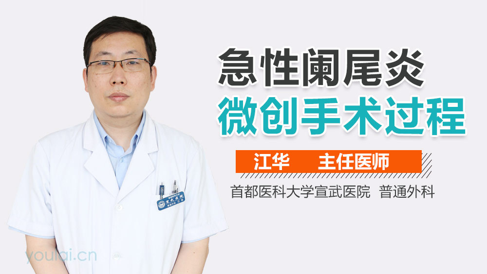 急性阑尾炎微创手术过程