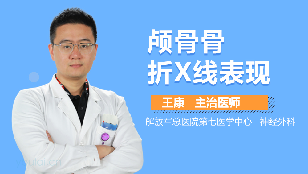 颅骨骨折X线表现