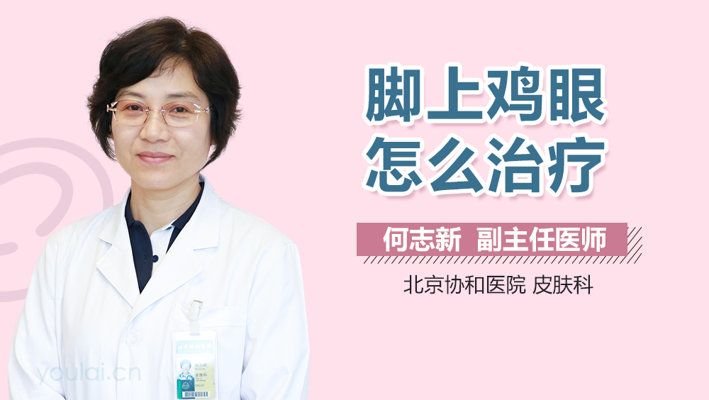 脚上鸡眼怎么治疗
