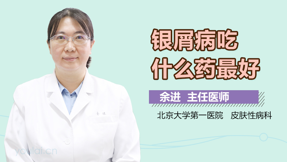 银屑病吃什么药最好