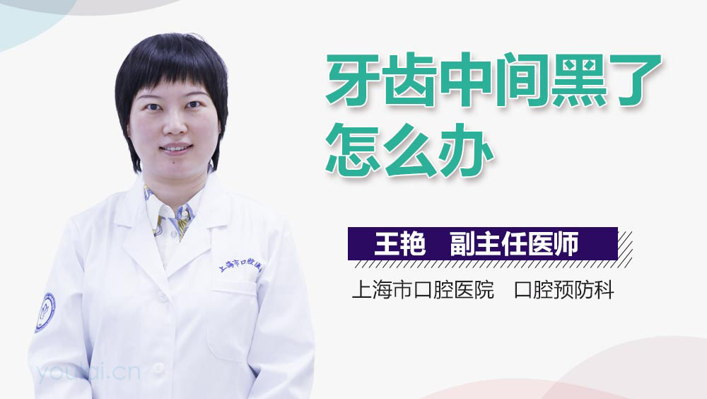 牙齿中间黑了怎么办