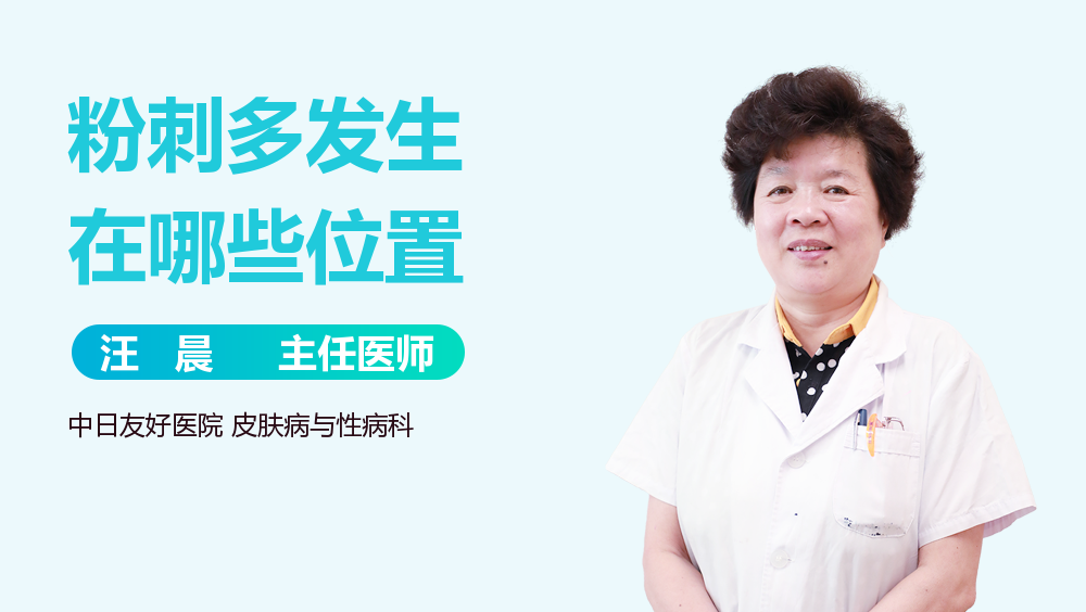 粉刺多发生在哪些位置