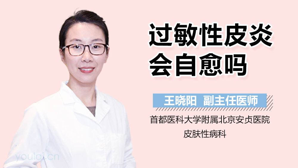 过敏性皮炎会自愈吗