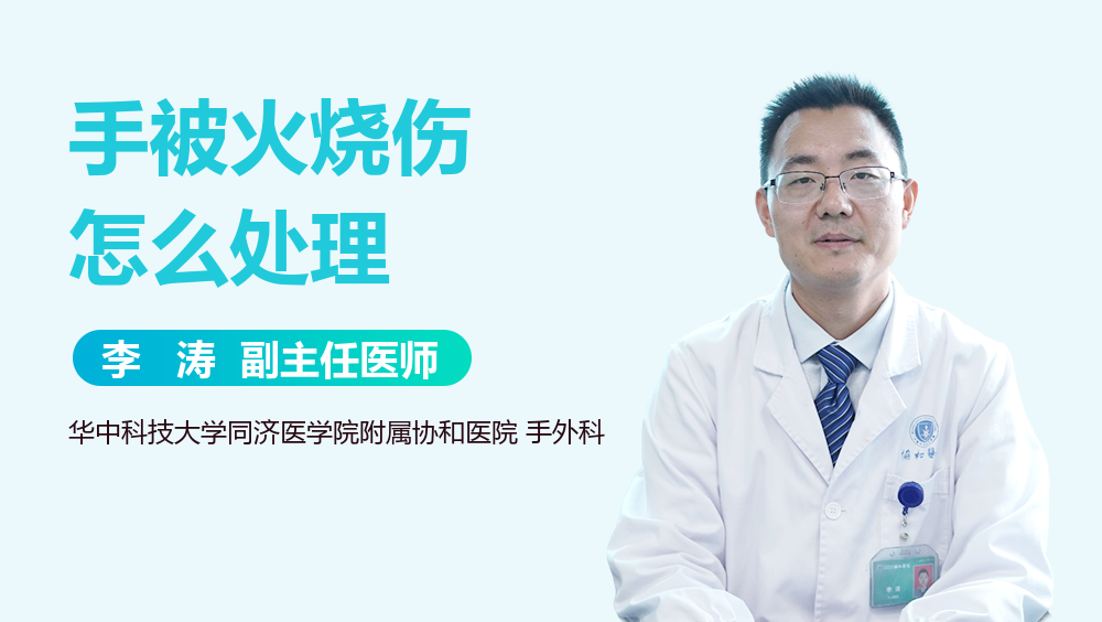 手被火烧伤怎么处理