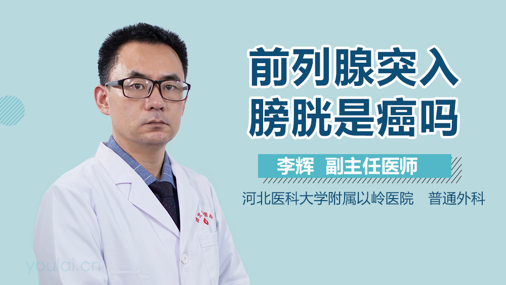 前列腺突入膀胱是癌吗