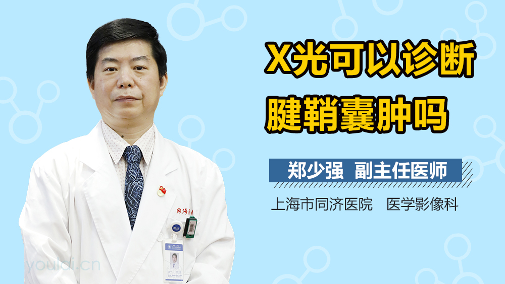 X光可以诊断腱鞘囊肿吗