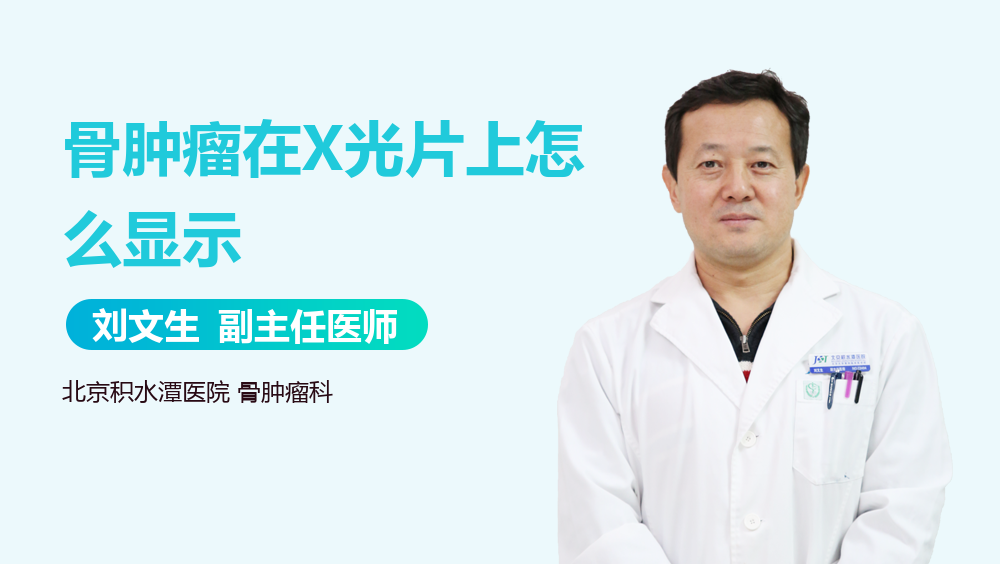 骨肿瘤在X光片上怎么显示