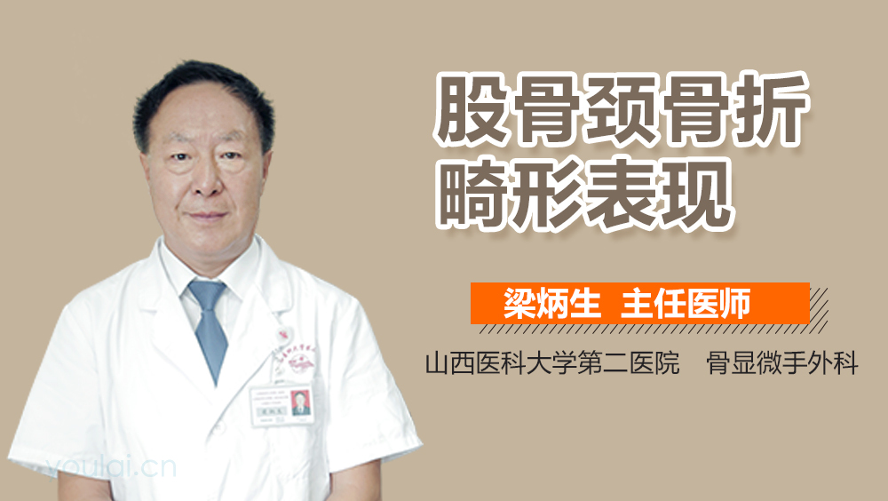 股骨颈骨折畸形表现