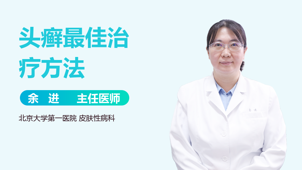 头癣最佳治疗方法
