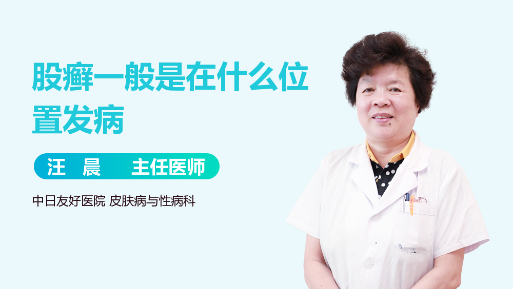股癣一般是在什么位置发病