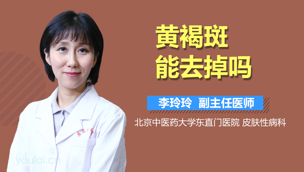 黄褐斑能去掉吗