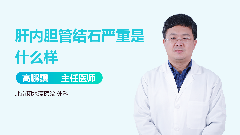 肝内胆管结石严重是什么样