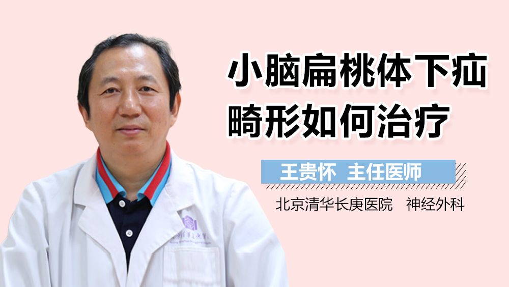 小脑扁桃体下疝畸形如何治疗