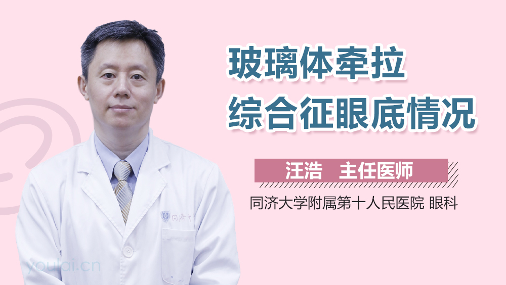 玻璃体牵拉综合征眼底情况
