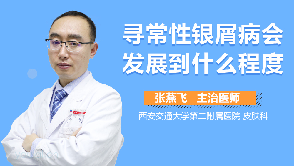 寻常性银屑病会发展到什么程度