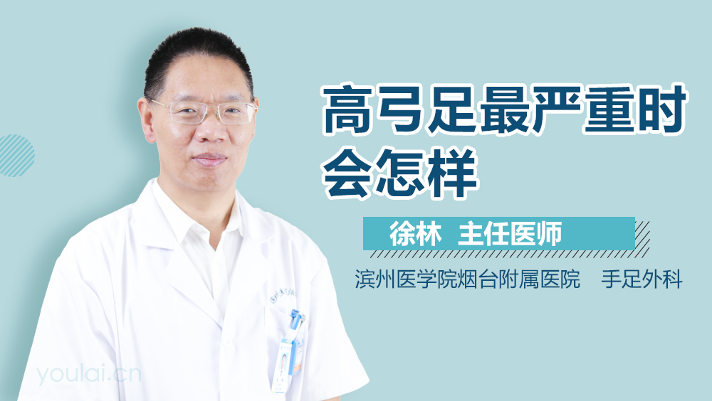 高弓足最严重时会怎样