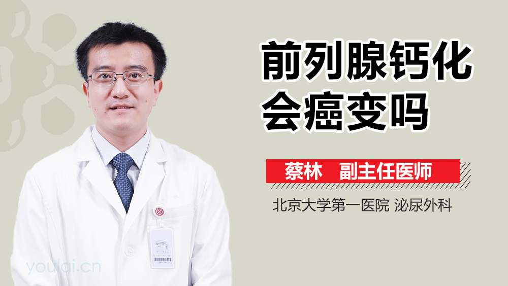 前列腺钙化会癌变吗