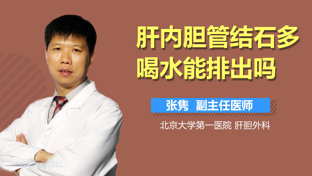肝内胆管结石多喝水能排出吗