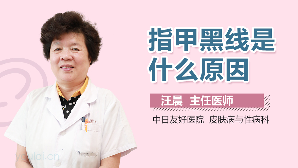 指甲黑线是什么原因