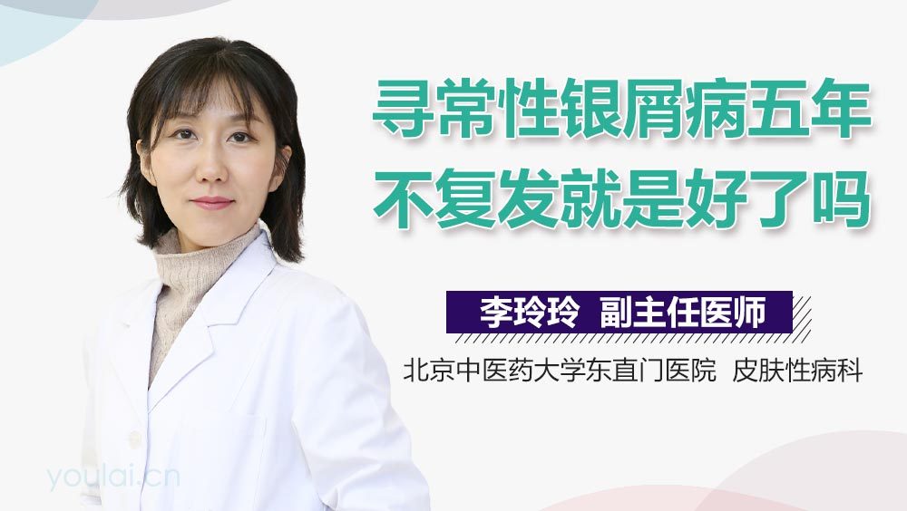 寻常性银屑病五年不复发就是好了吗