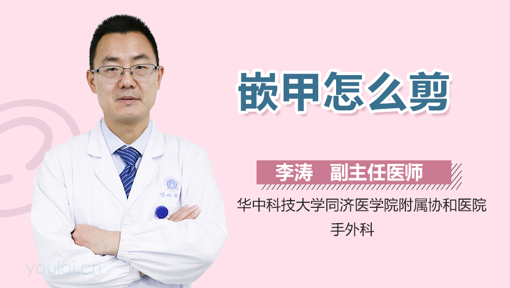 嵌甲怎么剪