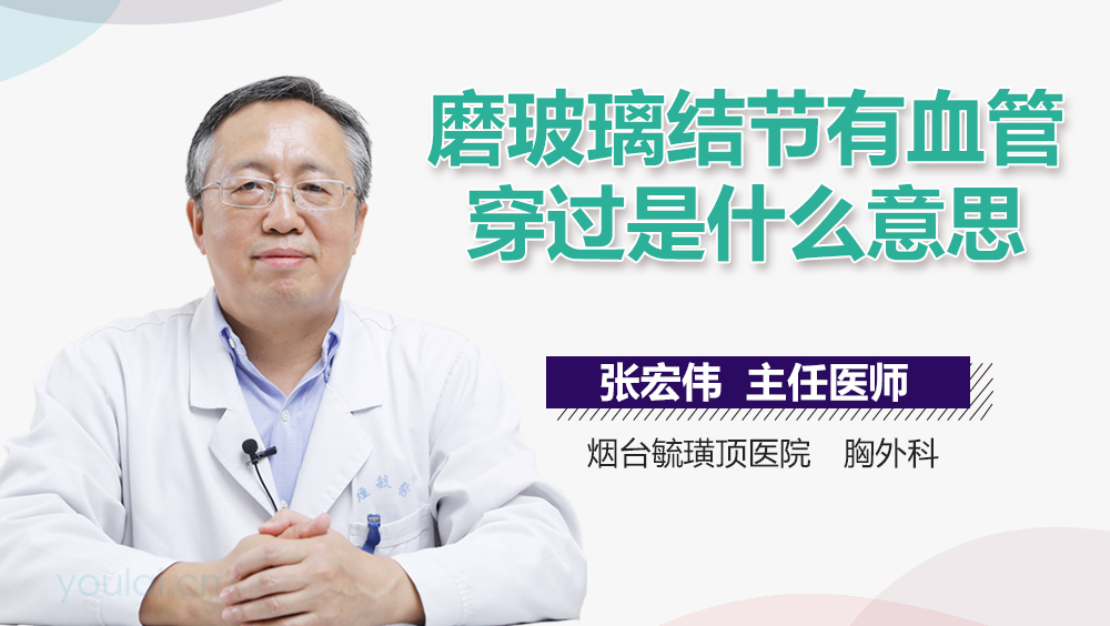 磨玻璃结节有血管穿过是什么意思