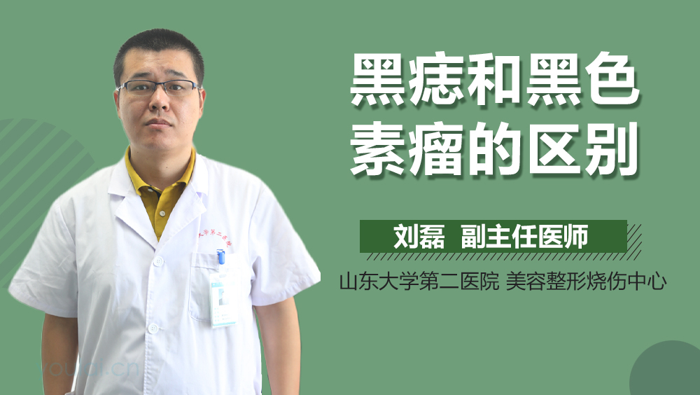 黑痣和黑色素瘤的区别