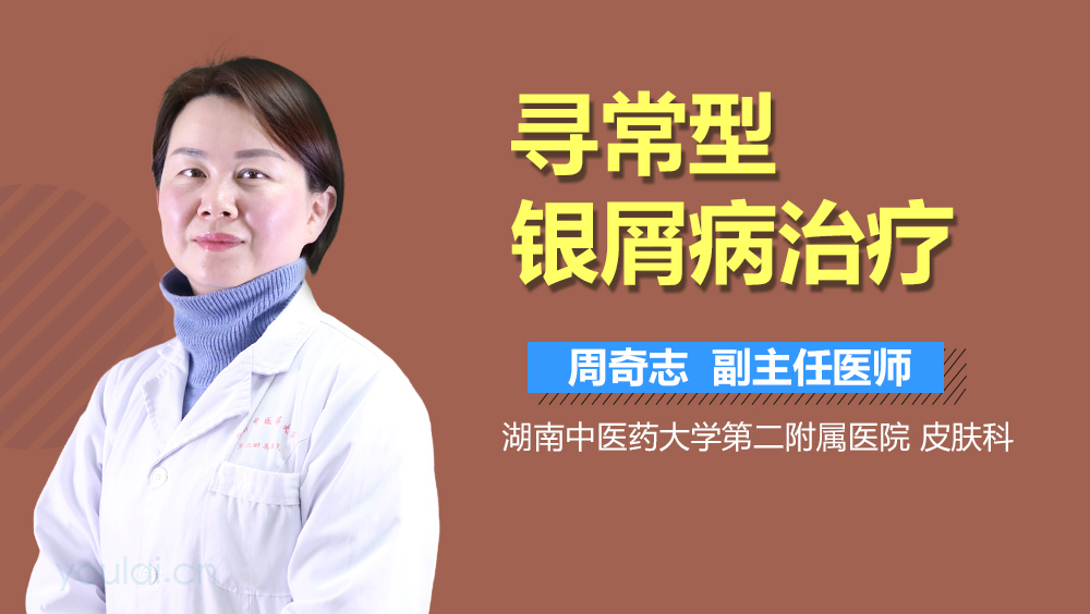 寻常型银屑病治疗