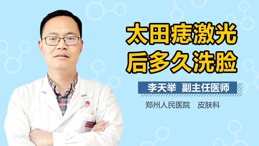 太田痣激光后多久洗脸