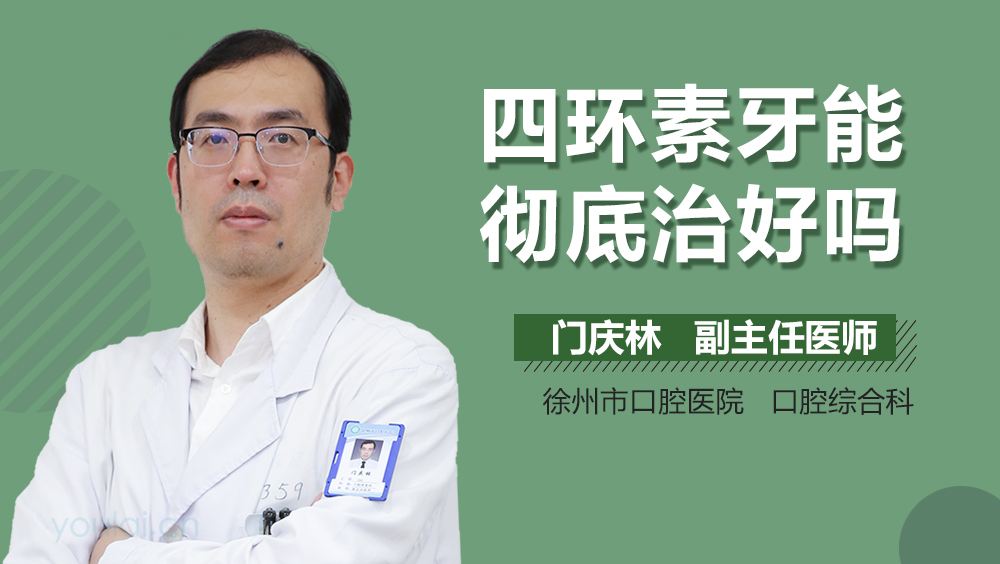 四环素牙能彻底治好吗