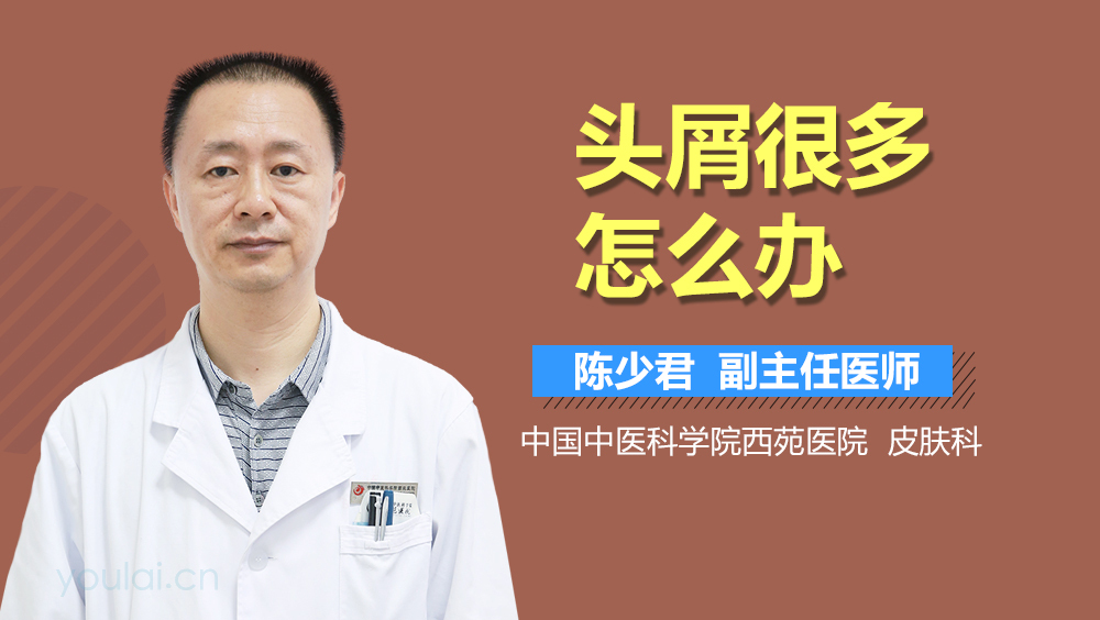 头屑很多怎么办