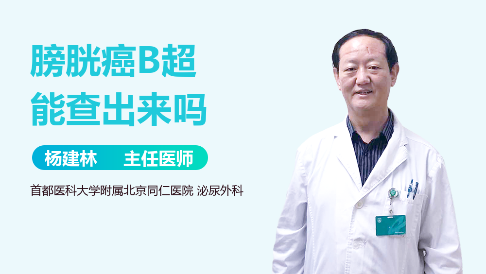 膀胱癌B超能查出来吗