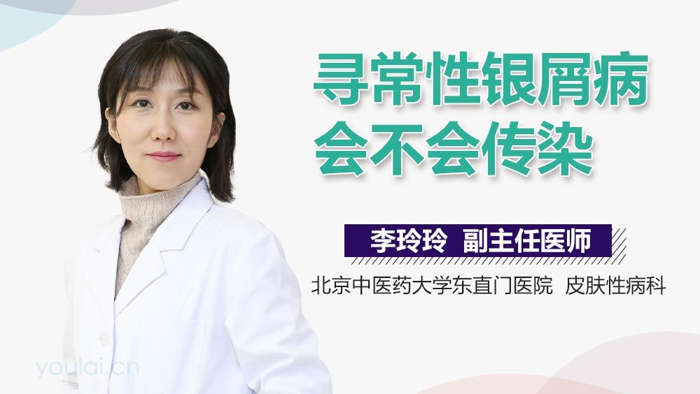 寻常性银屑病会不会传染