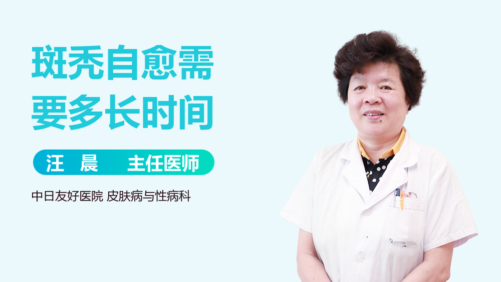 斑秃自愈需要多长时间