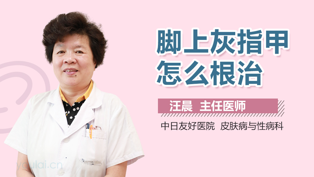 脚上灰指甲怎么根治