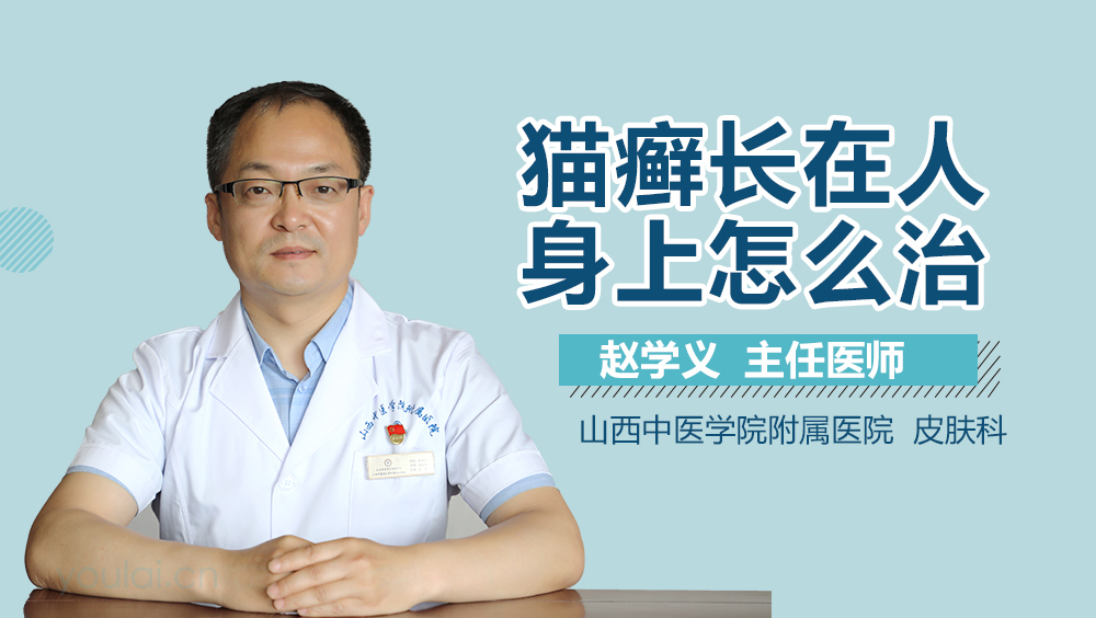 猫癣长在人身上怎么治