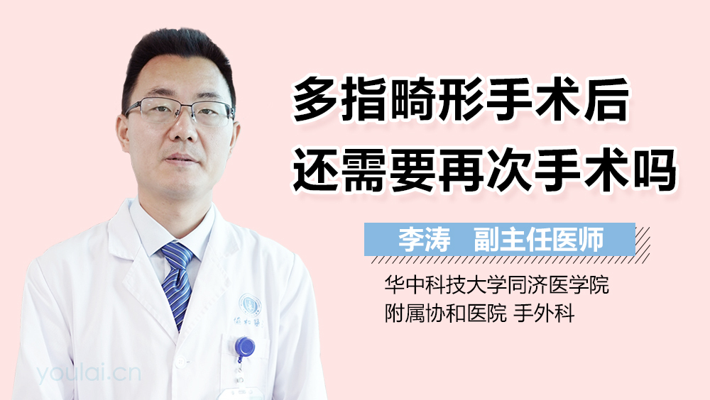 多指畸形手术后还需要再次手术吗