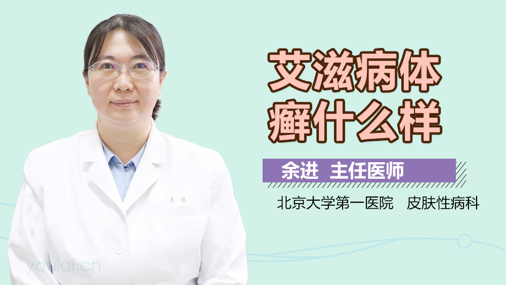 艾滋病体癣什么样
