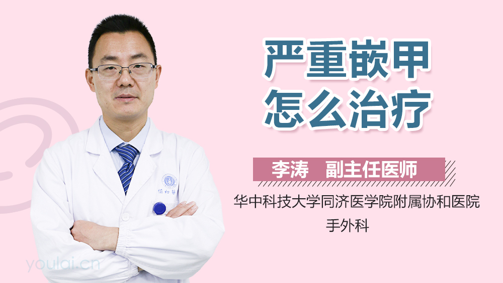 严重嵌甲怎么治疗