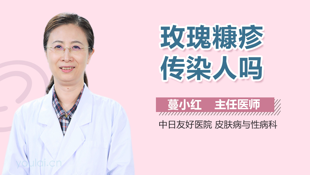 玫瑰糠疹传染人吗